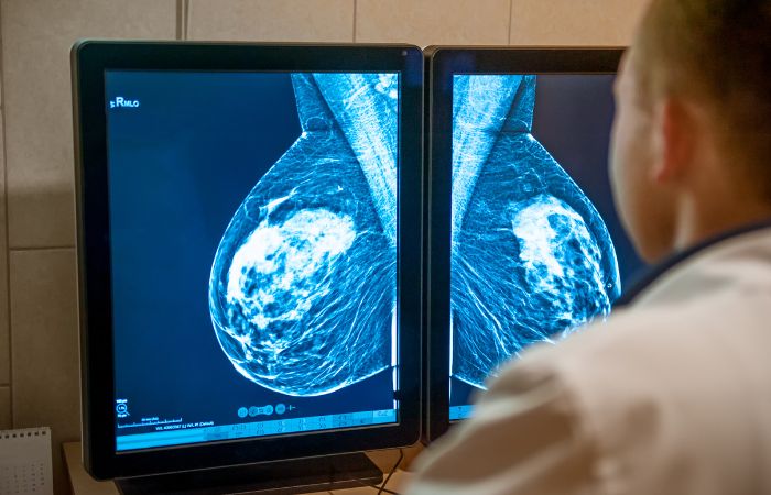 Mammogram Signs